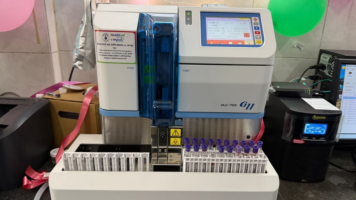 CMPDI Boosts Healthcare in Nagpur with Advanced Diagnostic Facilities Under CSR